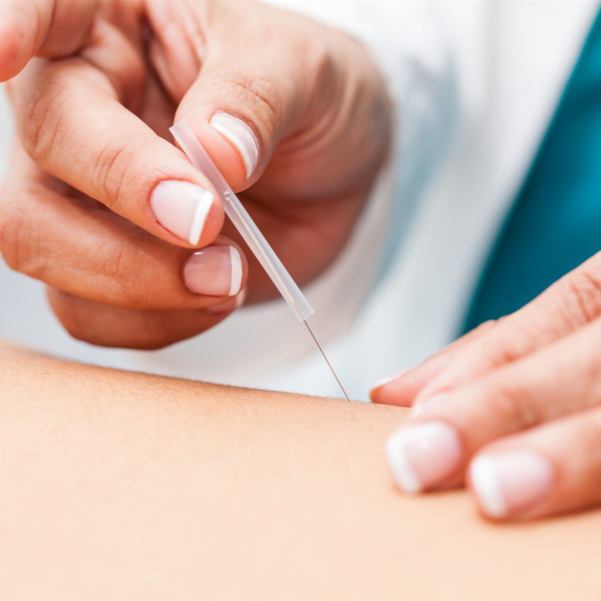 Aatral Acutherapy practitioners — R Meenakshi, Mohan Ramanujam, and Divya V at the Chennai clinic