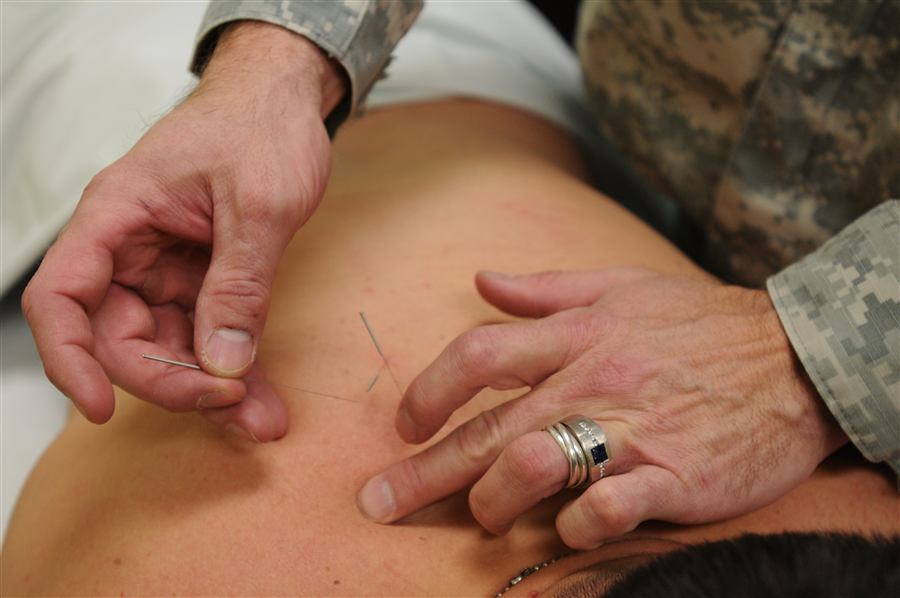 Supportive acupuncture care for oncology patients at Aatral Acutherapy, Chennai